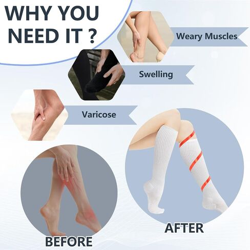 + جوارب ضغط قطنية MD للنساء والرجال 4/6 أزواج 8-15/15-20 مم زئبقي جوارب طويلة للركبة للرياضة والسفر والممرضات والوذمة in Kuwait