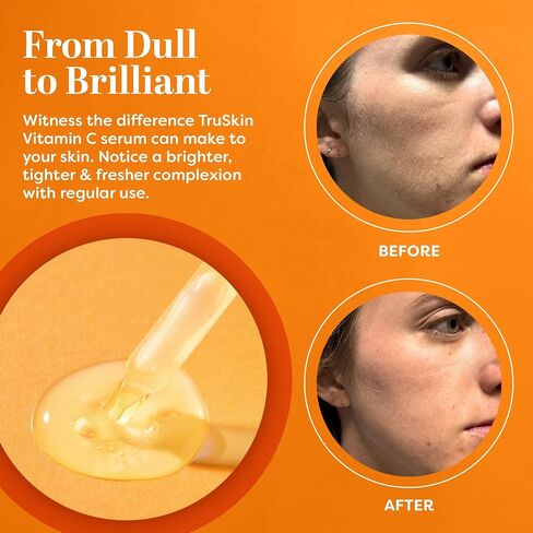 TruSkin Vitamin C Serum – Anti Aging Facial Serum with Vitamin C, Hyaluronic Acid, Vitamin E – Brightening Serum – Even Skin Tone, Improve Appearance of Dark Spots, Fine Lines & Wrinkles, 1 Fl Oz in Saudi Arabia