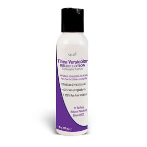 Naturasil Tinea Versicolor Treatment Lotion Sulfur Based, Powerful & Fast Antifungal Relief for Skin + Foot Itch, Discoloration & Discomfort| Safe for Kids & Adults| Gentle for All Skin Types|113g