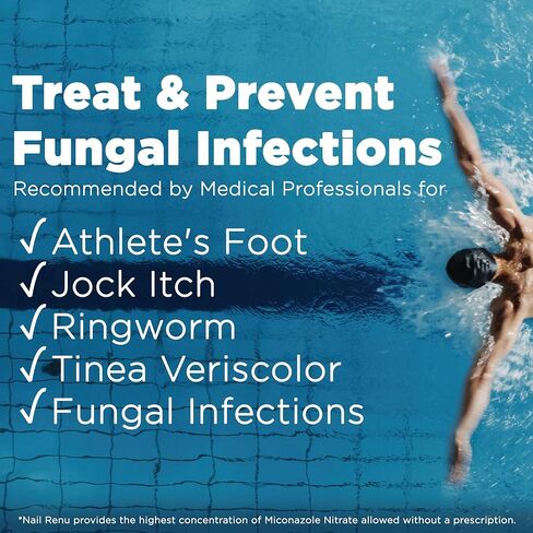 Miconazole Antifungal Cream | Skin and Foot Fungus Treatment Extra Strength | Miconazole Nitrate 2% for Jock Itch, Ringworm, and Athletes Foot (1oz) in Saudi Arabia