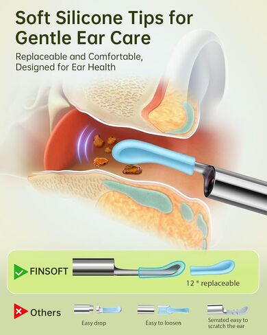 Ear Wax Removal Tool Camera, Ear Cleaner with Camera, Ear Wax Removal Cleaning Kit with 1296P HD Camera and 6 LED Lights, Earwax Removal Kit with 10 Ear Pick for iOS and Android, Black in Saudi Arabia