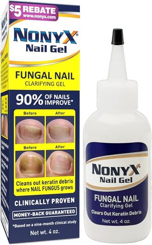NONYX Fungal Nail Clarifying Gel | Rids Nails of Fungus by Removing Keratin Debris Where Nail Fungus Grows | 90% of Toenails Improved Using this Toenail Fungus Treatment | 4 oz in Saudi Arabia