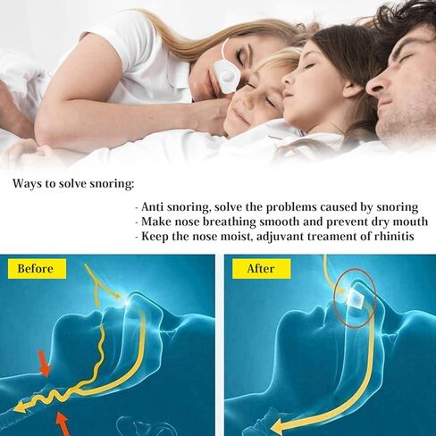 4 in 1 Anti snoring Devices,2023 New Atomization snoring Solution,Right Amount Fog,Adjustable Wind Force Sleep Apnea Devices for Comfortable Sleep in Kuwait
