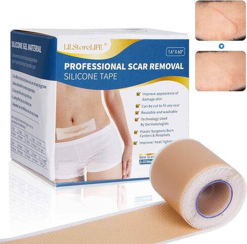 Silicone Scar Sheets, Silicone Scar Tape Roll (60"x1.6"), Professional Scars Removal Treatment, Scar Silicone Strips, Reusable Silicone Scar Strips Type for Keloid, C-Section, Surgery, Keloid, Acne in Saudi Arabia