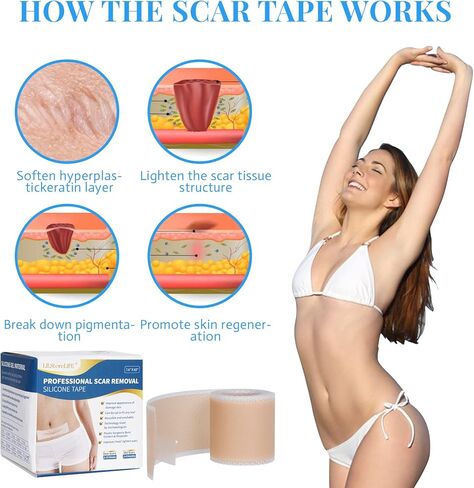 Silicone Scar Sheets, Silicone Scar Tape Roll (60"x1.6"), Professional Scars Removal Treatment, Scar Silicone Strips, Reusable Silicone Scar Strips Type for Keloid, C-Section, Surgery, Keloid, Acne in Saudi Arabia
