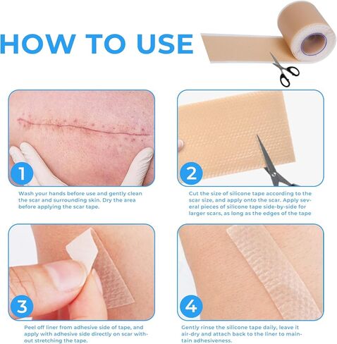 Silicone Scar Sheets, Silicone Scar Tape Roll (60"x1.6"), Professional Scars Removal Treatment, Scar Silicone Strips, Reusable Silicone Scar Strips Type for Keloid, C-Section, Surgery, Keloid, Acne in Saudi Arabia