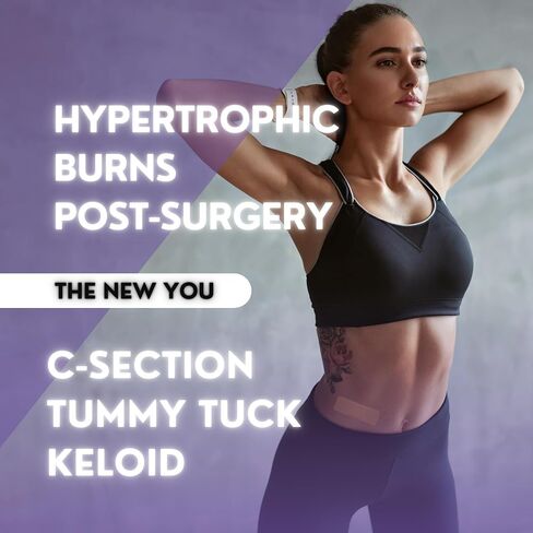 Premium Silicone Scar Sheets | Medical-Grade, Fast Acting for C-Section, Keloid, Burns, Tummy Tuck Scars in Saudi Arabia