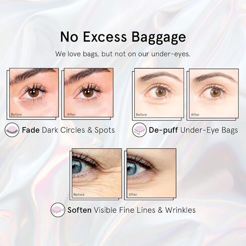 grace & stella Under Eye Patches for Puffy Eyes and Dark Circles (Retinol, 24 Pairs) Restoring Gel Under Eye Masks with Hyaluronic Acid - Vegan Cruelty-Free Skincare Birthday Gifts for Women in Saudi Arabia