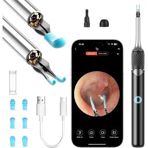 Ear Wax Removal, Ear Camera with Omnidirectional Tweezers, Otoscope with 1080P Camera, Ear Wax Removal Kit with 6 Ear Pick