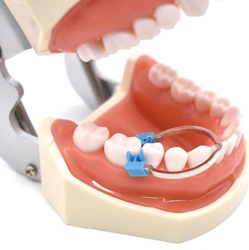 1 Set Dental Sectional Matrices Clip, Dental Matrix Sectional Contoured Matrices Clamps,Spring Clip,Forming Sheet Clip, Dentist Matrix Ring Tools (Type A) in Kuwait