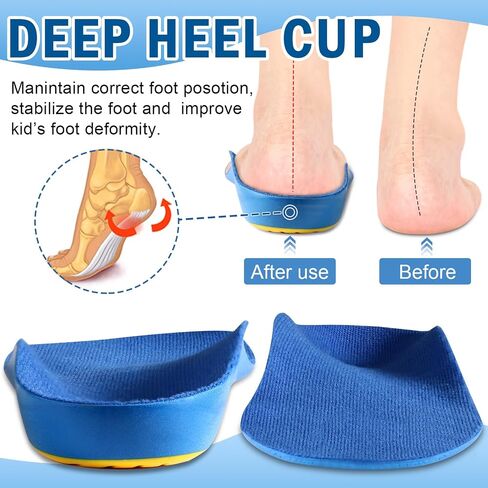 Ailaka Kids Orthotic Cushioning Arch Support Shoe Insoles, Children Pu Foam Inserts for Flat feet, Plantar Fasciitis, Feet Heel Pain Relief Blue in Kuwait