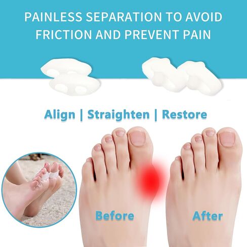 Silicone Toe Spacers Big Toe Straightener for Feet Correct Toes Yoga Toe Straightener for Correct Toe Alignment Hammer Toe Corrector Toe Spreader Foot Stretcher (5 Holes, 4 Beige) in Saudi Arabia