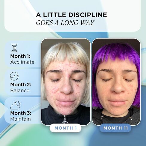 Blur Potion™ by ZitSticka, Vitamin Supplement to Fade The Appearance of Hyperpigmentation, Melasma and Dark Spots, 30 Caps in Saudi Arabia