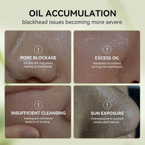 مزيل الرؤوس السوداء من لانبينا - قناع تقشير للأنف والوجه، مجموعة إزالة الرؤوس السوداء مع بريلي - 1.05 أونصة in Kuwait