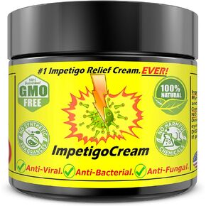 ImpetigoCream Adults Kids Ointment Cream Salve Skin with Tea Tree Oil Fast Scar All Clear