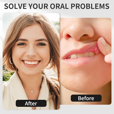 Red Light Therapy Device, Cold Sore Canker Sore Treatment for Lips, Handheld Infrared Light Therapy for Mouth Sore Relief, Nose Ear Knee Hands Joint Muscle Nerve Pain Relief 3-in-1 Device in Kuwait