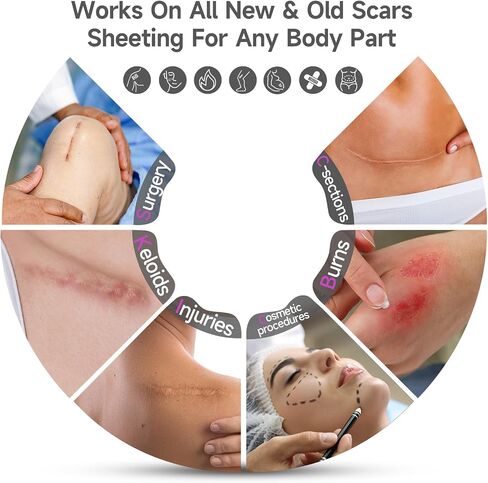 Advanced Scar Cream Silicone Scar Gel Scar Removal Cream for Face, Body, Surgical, C-section, Stretch Marks, Acne, Injury, Burns, Keloids, Old and New Scars 1.7 oz(50g) in Saudi Arabia