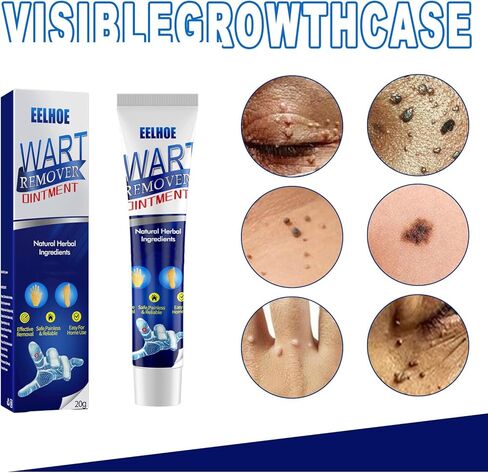 Wart Remover Freeze Off,with Salicylic Acid for Removal of Common and Plantar Warts,1 Pack Fast-Acting Wart Remover in Saudi Arabia