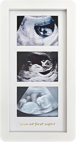 Love at First Sight Ultrasound Picture Frames,Triple Ultrasound Picture Frames,Sonogram Picture Frame 3 Photos,Pregnancy Announcements (White) in Saudi Arabia