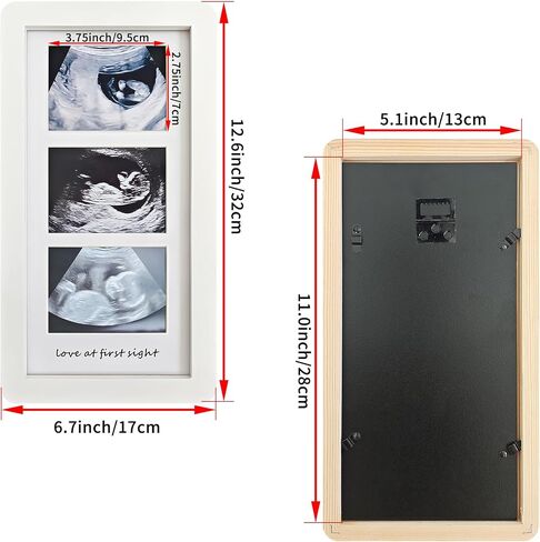 Love at First Sight Ultrasound Picture Frames,Triple Ultrasound Picture Frames,Sonogram Picture Frame 3 Photos,Pregnancy Announcements (White) in Saudi Arabia