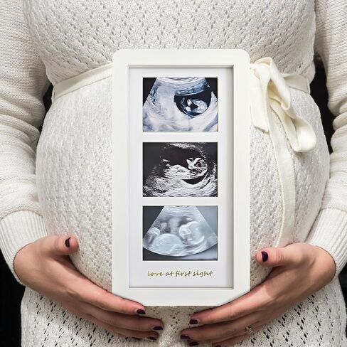 Love at First Sight Ultrasound Picture Frames,Triple Ultrasound Picture Frames,Sonogram Picture Frame 3 Photos,Pregnancy Announcements (White) in Saudi Arabia