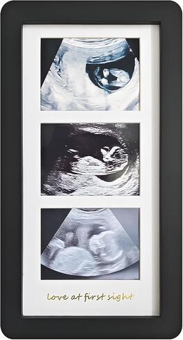 Love at First Sight Ultrasound Picture Frames,Triple Ultrasound Picture Frames,Sonogram Picture Frame 3 Photos,Pregnancy Announcements (White) in Saudi Arabia