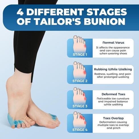 Tailor's Bunion Corrector and Pinky Toe Spacers Kit for Curled Toes and Pain Relief - Tailor Toe Separators, Pinky Toe Protectors, and Morton's Neuroma Relief (1 Pair) in Saudi Arabia