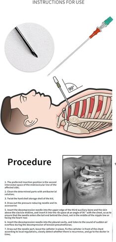 14G Chest Decompression Needles Tension Pneumothorax Needle Outdoor Emergency Tools, 5pcs in Saudi Arabia