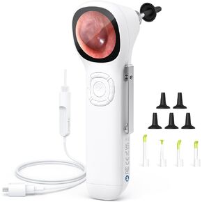 ScopeAround Digital Otoscope with IPS Screen, 720p HD Smart Visual Ear Camera, Ear Scope Otoscope Camera with 6 LED Lights, Ear Wax Removal Tool Camera, Plug & Play