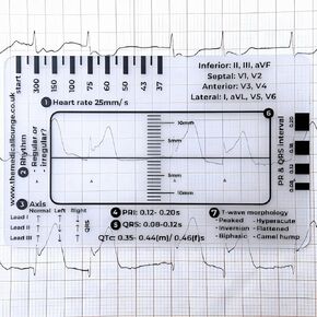 ECG/EKG Ruler, 7 Step ECG Interpretation Tool, Portable EKG Measuring Card, Transparent ECG Ruler for Nurses and Students, Badge Buddy Nursing Accessory (1 Pcs)