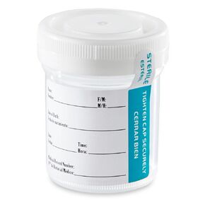 Globe Scientific 6523TP Tite-Rite Container with White Screw Cap, Thermometer Strip, and ID Label with Tab Seal, 60mL (2 oz), PP, Sterile, Graduated, Pack of 500