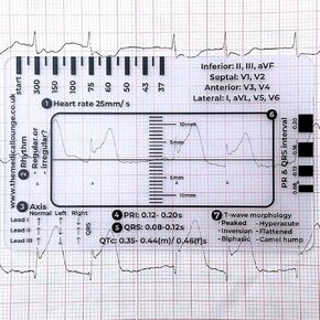 2PCS Electrocardiogram 7 Step Ruler, for Electrocardiogram Interpretation, Follow a 7 Step Plan Portable Electrocardiogram Assessment Tool, Portable Electrocardiogram Reference Tool