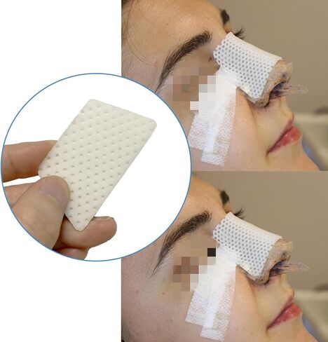 Thermoplastic Nasal Splints - Rhinoplasty Septoplasty Surgery Nose External Support Protector for Orthopedic Immobilization, Nose Brace Fracture,5 PCS (L) in Saudi Arabia