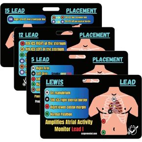 Scope EKG Lead Placement Cards – 5 Lead 12 Lead 15 Lead Lewis Lead EKG Placement for Nurse, Paramedic Students, Med School – Waterproof Plastic EKG Badge Card – Horizontal Double Sided Layout