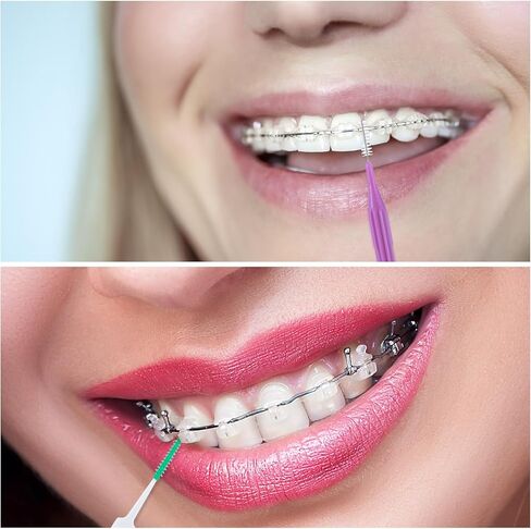 250 قطعة من فرشاة تقويم الأسنان من WLLHYF، فرشاة تنظيف بين الأسنان للاستعمال مرة واحدة، رأس ناعم لتنظيف الأسنان، أداة تنظيف الأسنان، أداة تنظيف الأسنان لتنظيف الأسنان in Kuwait