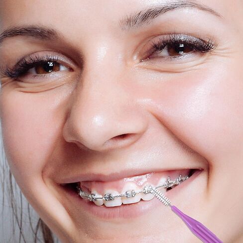 250 قطعة من فرشاة تقويم الأسنان من WLLHYF، فرشاة تنظيف بين الأسنان للاستعمال مرة واحدة، رأس ناعم لتنظيف الأسنان، أداة تنظيف الأسنان، أداة تنظيف الأسنان لتنظيف الأسنان in Kuwait