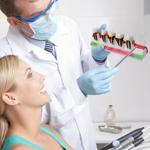Dental Caries Developing Model, Dental Teeth Model for Dental Tooth Anatomy Study, Doctor-Patient and Oral Care Education in Kuwait