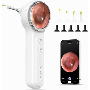 ScopeAround Digital Otoscope with 1.85 in IPS Screen, 720p HD Smart Visual Ear Camera, Ear Scope with Gyroscope, Wireless Otoscope with 6 LED Lights, Compatible with Android/iPhone