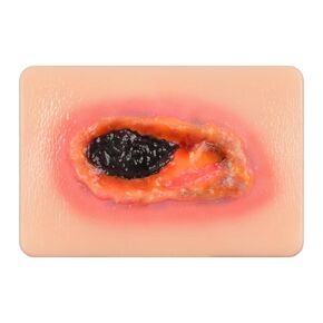 Wound Packing Trainer, Dry Necrotic Wound Simulation Models for Medical Education, Wound Care Demonstrations Tool