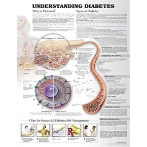 Understanding Diabetes Anatomical Chart