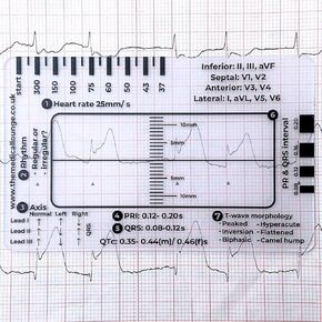 2pcs EKG 7 Step Ruler, EKG Ruler Plastic Ruler Measuring Tool, EKG 7 Step Ruler for EKG Interpretation, Transparent EKG Calipers Measuring Tool, Easy-to-Carry EKG Ruler, Follow a 7 Step Plan