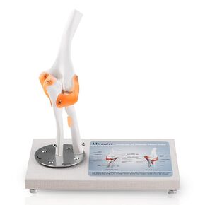 Human Elbow Joint Model, Flexible 1:1 Life Size with Ligaments 360° Rotatable Wooden Display Base, Anatomical Model, Skeleton Model for Patient Education & Medical Training