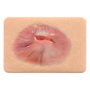 Wound Packing Trainer, Healing Granulation Wound Simulation Models for Medical Education, Wound Care Demonstrations Tool