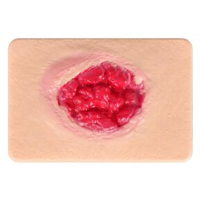 Wound Packing Trainer, Overgrown Granulation Wound Simulation Models for Medical Education, Wound Care Demonstrations Tool