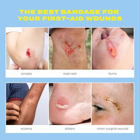 Superband Hydrocolloid ضمادات مضادة للماء خلط الجرح بواسطة Makeitskin | شفاء رفيع وسريع ، ندبة تقلل من الخدوش ، القطع ، الحروق ، البثور ، طفح الطريق in Saudi Arabia