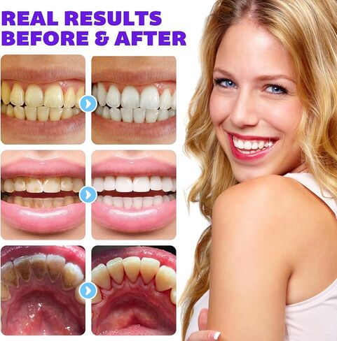 Purple Toothpaste Tablets,Flouride Free Toothpaste Tablets,Sensitive Toothpaste Tablets,Travel Toothpaste,Hydroxyapatite Toothpaste Tablets,Purple Whitening Toothpaste,(70PCS,Grape Flavors) in Kuwait