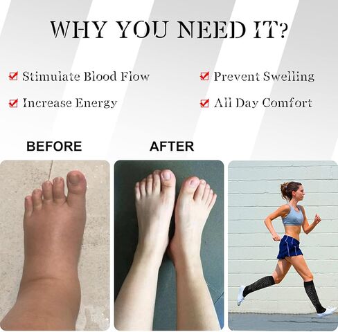 جوارب ضغط نسائية عاكسة للدوران 20-30 مم زئبق جوارب ضغط طبية عالية التخرج للركبة in Kuwait