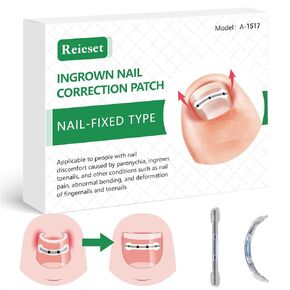 Titanium Alloy Ingrown Toenail Treatment, Nail Tools, and Ingrown Toenail Removal Kit Specially Designed for Curved Nail Repair and Ingrown Toenail Corrector(0.59/0.67in)