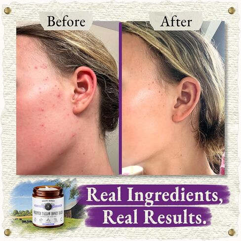 Wrath & Remedy Handmade Whipped Organic Beef Tallow for Skin - 4 OZ (Lavender) — Grass Fed Beef Tallow Moisturizer and Honey Balm for Silky, Sensitive-Skin, Eczema, Rosacea - Free of Harsh Chemicals in Saudi Arabia