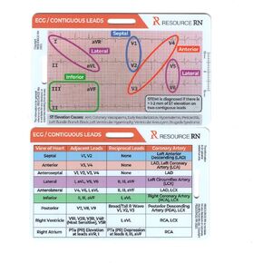 EKG STEMI Analysis Badge Card for Rapid Interpretation – Compatible for Both Horizontal & Vertical Layout